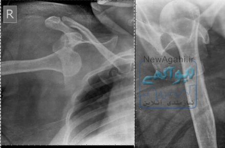  رادیولوژی پرتابل در منزل امید