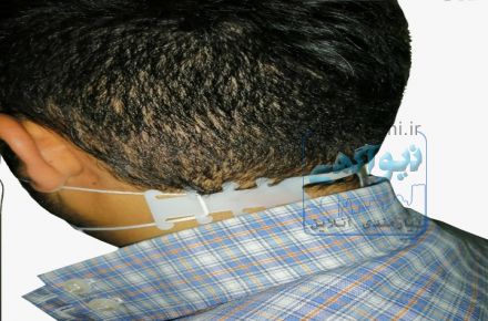 گیره نگهدارنده ماسک صورت بلته مدل MR7346