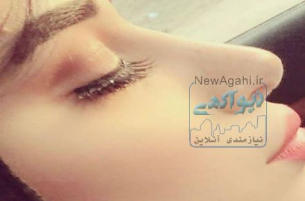 جراحی بینی