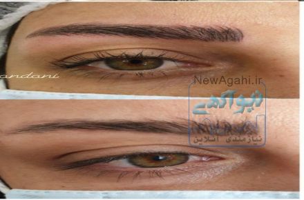 خدمات رایگان میکروبیلدینگ و فیبروز ابرو