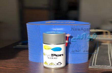 کرایوتراپی(حذف خال و زگیل تناسلی)