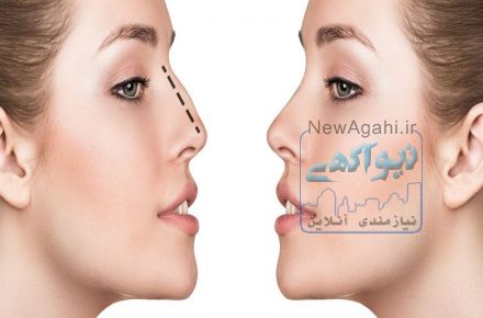 جراحی تضمینی بینی در تهران