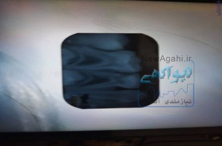 رادیولوژی و سونوگرافی در منزل(پرتابل) امید