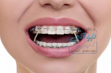 کلینیک دکتر سریتا پیشتاز در خدمات ارتودنسی