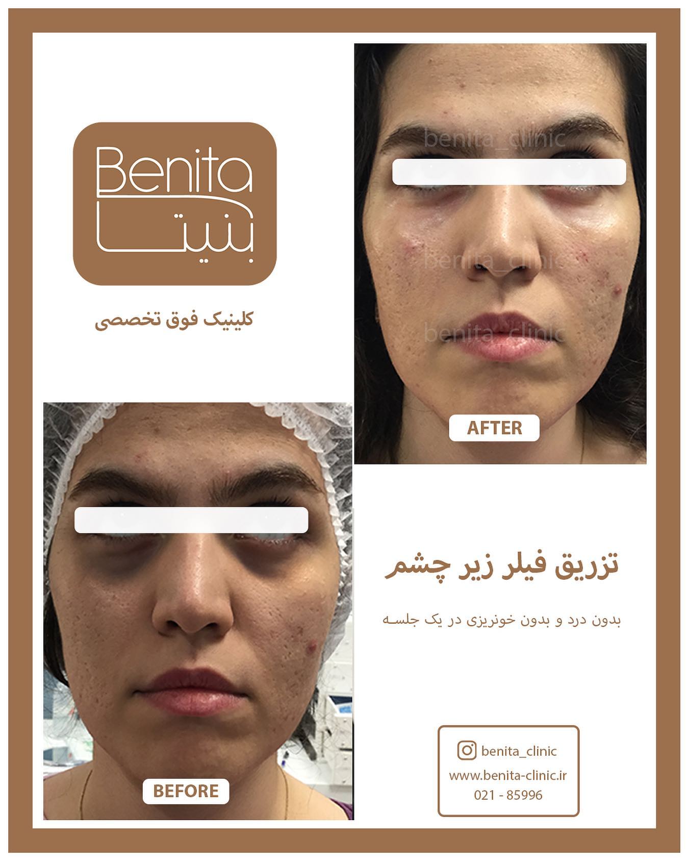 قیمت لاغری با ترواسکالپ