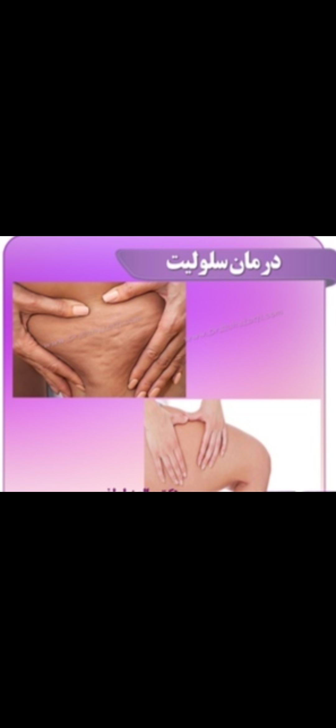 انواع خدمات ماساژ در محل شما