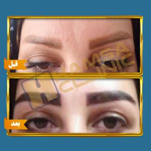کلینیک زیبایی و کاشت مو همسا