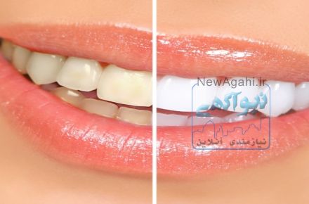 اپلیکیشن اندرویدی دکتر دندان-سفید کردن فوری 