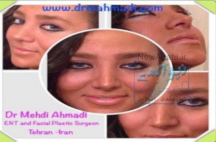 بهترین جراح بینی دکتر مهدی احمدی