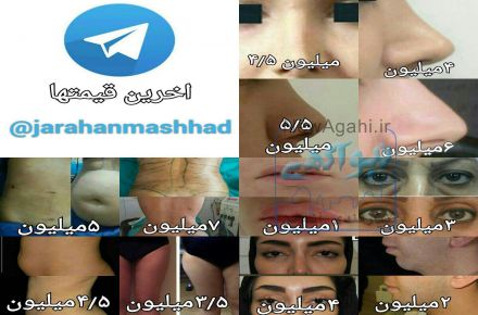 عمل جراحی بینی در مشهد
