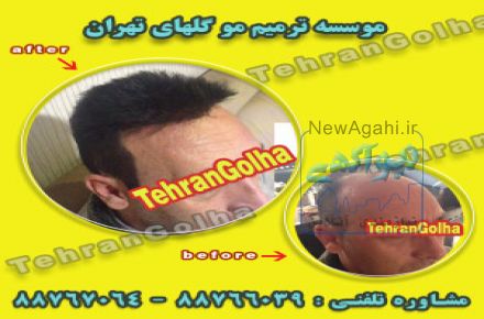خدمات رایگان ترمیم مو 