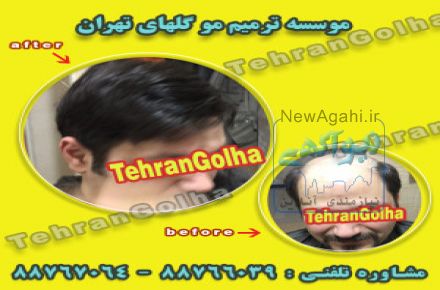 خدمات رایگان ترمیم مو 