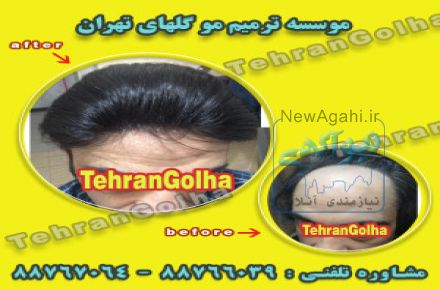 خدمات رایگان ترمیم مو 
