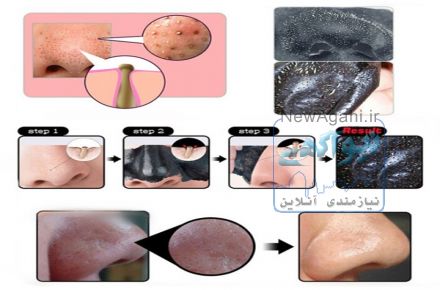 بلک ماسک سودا ماسک سیاه ماسک ذغال
