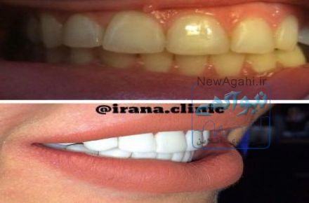 مرکز تخصصی و زیبایی ٰ ایمپلنت و جراحی فک ایرانا