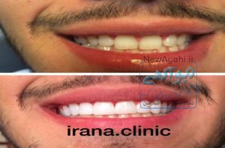 مرکز تخصصی و زیبایی ٰ ایمپلنت و جراحی فک ایرانا