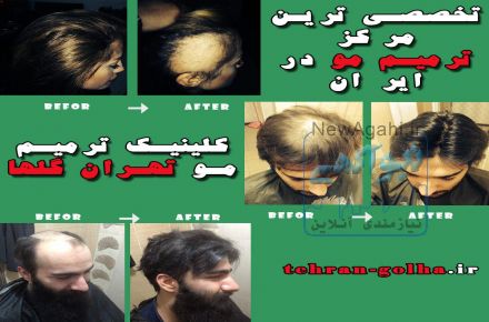 ترمیم مو گلهای تهران نماینده رسمی های فیکس آلمان