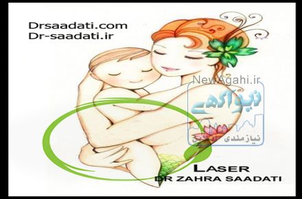 شقاق مقعد یا فیشر در زنان باردار