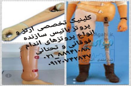 کلینیک تخصصی ارتز و پروتز باتیس