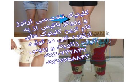 درمان پای پرانتزی در کودکان و بزرگسالان