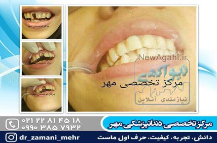 بهترین دندانپزشکی در شمال تهران