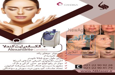 اجاره دستگاه الکساندرایت کندلا