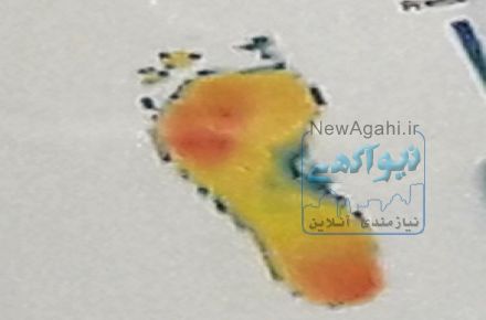 فوت اسکن (اسکن پا) ارتوپدی فنی