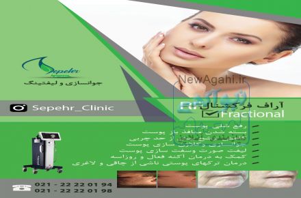 آر اف سوزنی : RF Fractional Secret