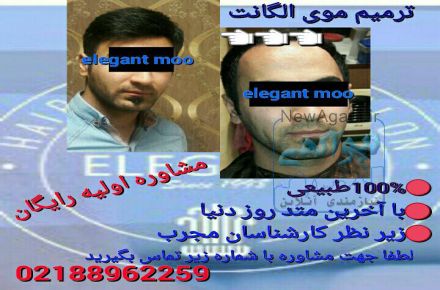 ترمیم و کاشت موی الگانت