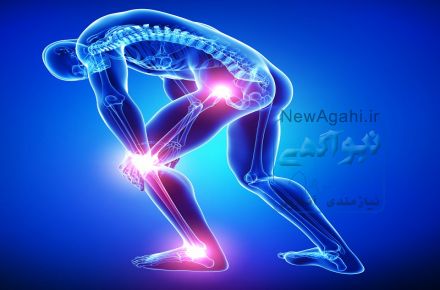 آرتروز زانو