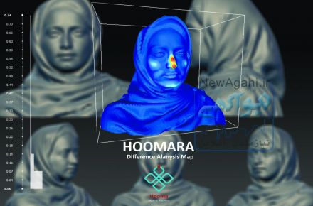 اسکن سه بعدی جراحی  زیبایی  کلینیک هومارا