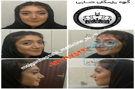 عمل زیبایی بینی