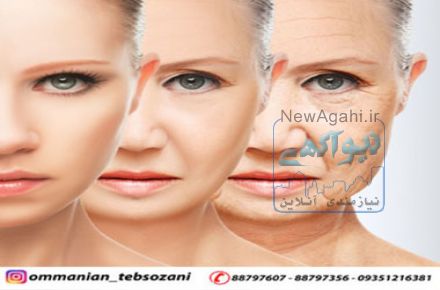 رفع شلی و افتادگی پوست صورت