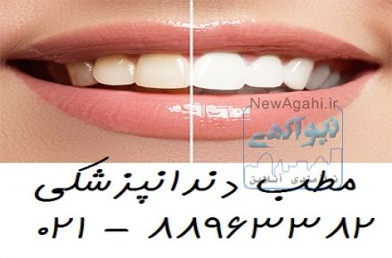 بهترین متخصص جراحی لثه جراحی دندان عقل   