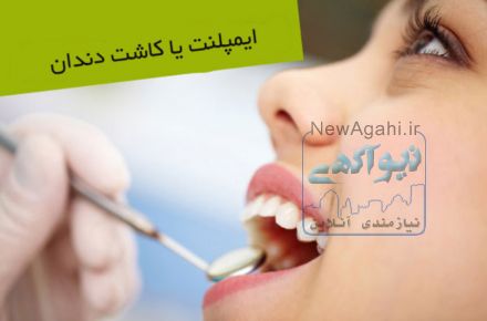 کلینیک تخصصی ونک ایمپلنت 