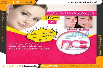 گیره کوچک کننده بینی
