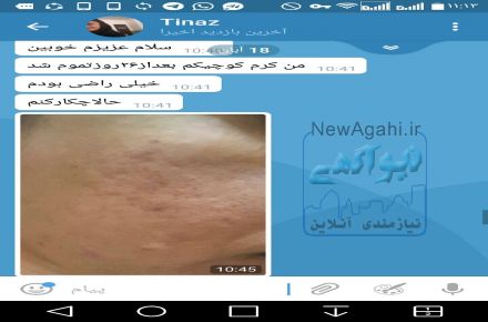 پکیج ضدجوش وضدلک