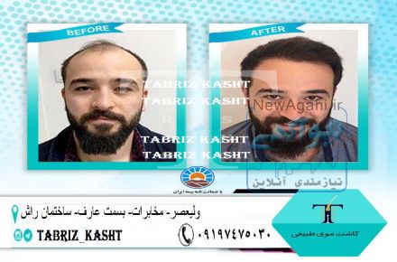 تبریز کاشت