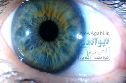 دستگاه عنبیه شناسی چشم