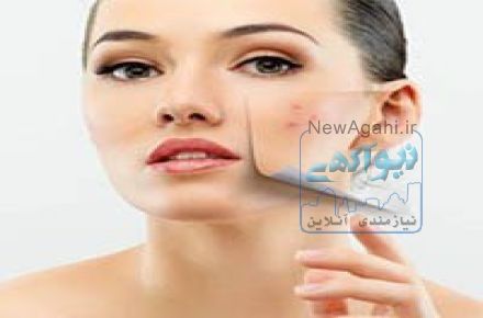 کلینیک لیزر موهای زاید در نیاوران