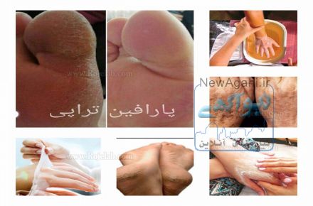 پارافین تراپی خانه زیبایی صدف شهرک اکباتان