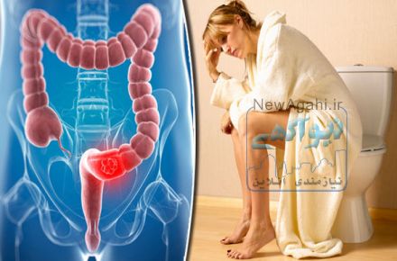  دکتر بیژن عابدیان متخصص بیماری های نشیمنگاهی