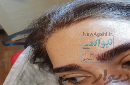 خدمات تخصصی میکروبلیدینگ و میکروپیگمنتیشن در سعادت آباد