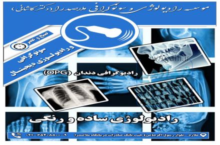 موسسه سونوگرافی و رادیولوژی ملاصدرا ملارد (دکتر کاشانی)