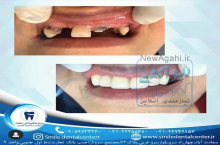  کلینیک دندانپزشکی لبخند،جراحی ایمپلنت پیشرفته،درمان ریشه،ترمیم دندان و ...