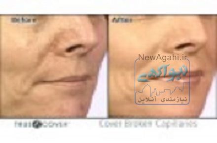 تروکاور ,کرم پوشاننده تروکاور