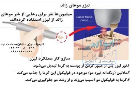 کلینیک پوست و لیزر ماهان